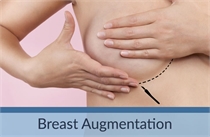 Breast Augmentation Los Angeles