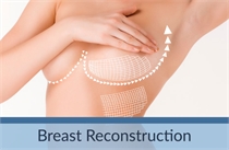 Breast Reconstruction Los Angeles