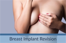 Breast Implant Revision Los Angeles